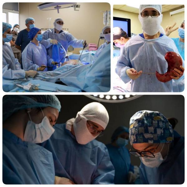 МАЙСТЕР–КЛАС «АБЕТКА РУКАВНОЇ РЕЗЕКЦІЇ ШЛУНКУ»