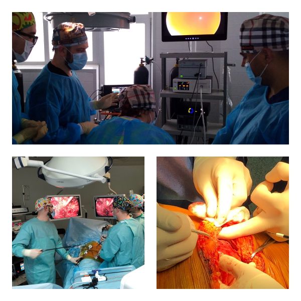  LAPAROSCOPIC ANATOMIC RESERVATION OF THE LIVER: SHOWS, TECHNIQUES, TIPS AND FASTINGS