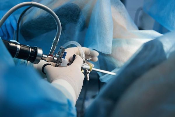 МАЙСТЕР КЛАС «ADVANCE ГІСТЕРОРЕЗЕКТОКОПІЯ"»